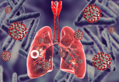 Что важно знать о туберкулезе?